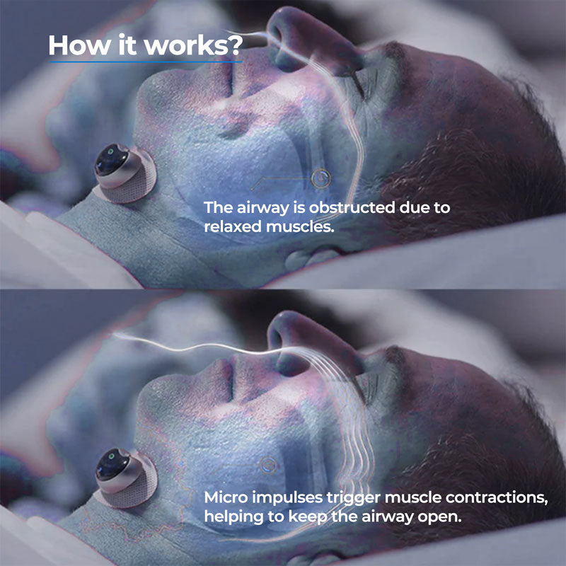 Anti Snore Device Chin Clip Sleep Aid For Quiet Nights - Tophatter Daily Deals