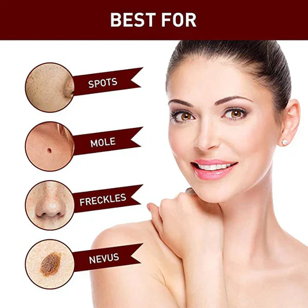 Skin Tag Mole Remover Pen With Tea Tree Oil Fast Home - Tophatter Daily Deals