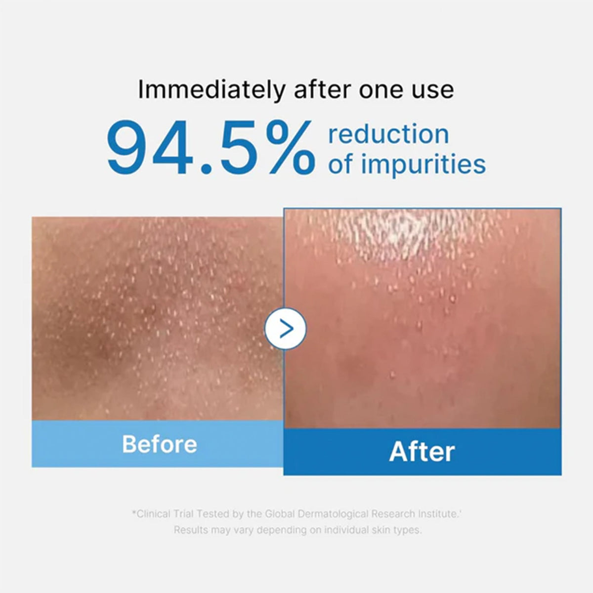 Medicube Zero Pore Blackhead Cleansing Oil 205ml Tube - Tophatter Daily Deals