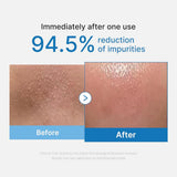 Medicube Zero Pore Blackhead Cleansing Oil 205ml Tube - Tophatter Daily Deals