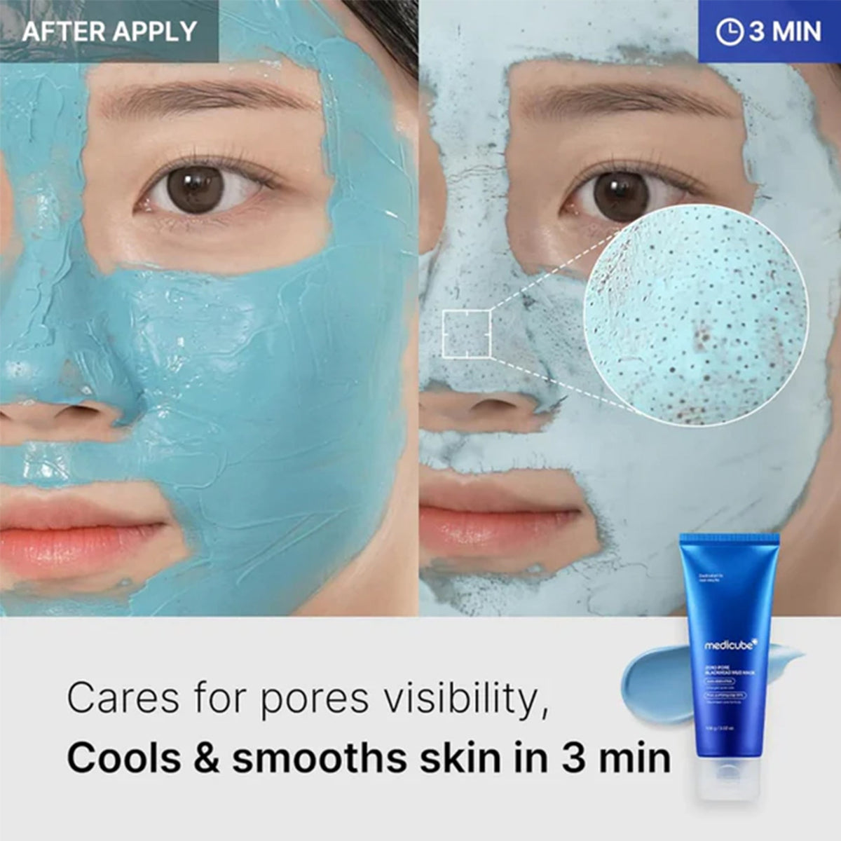 Medicube Zero Pore Blackhead Mud Mask 100ml Tube - Tophatter Daily Deals