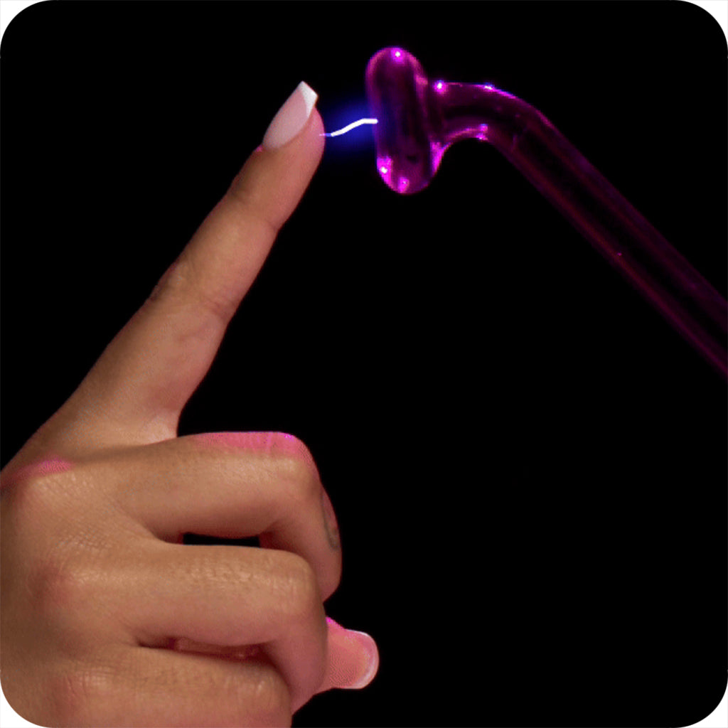 Zeus Ultimate Edition Violet Wand Set Bondage and Fetish > Electro Stim - Tophatter Daily Deals