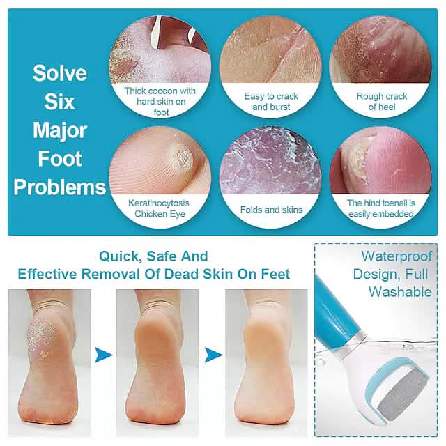 Mini Portable Electric Foot Grinding Machine Beauty & Personal Care - Tophatter Daily Deals