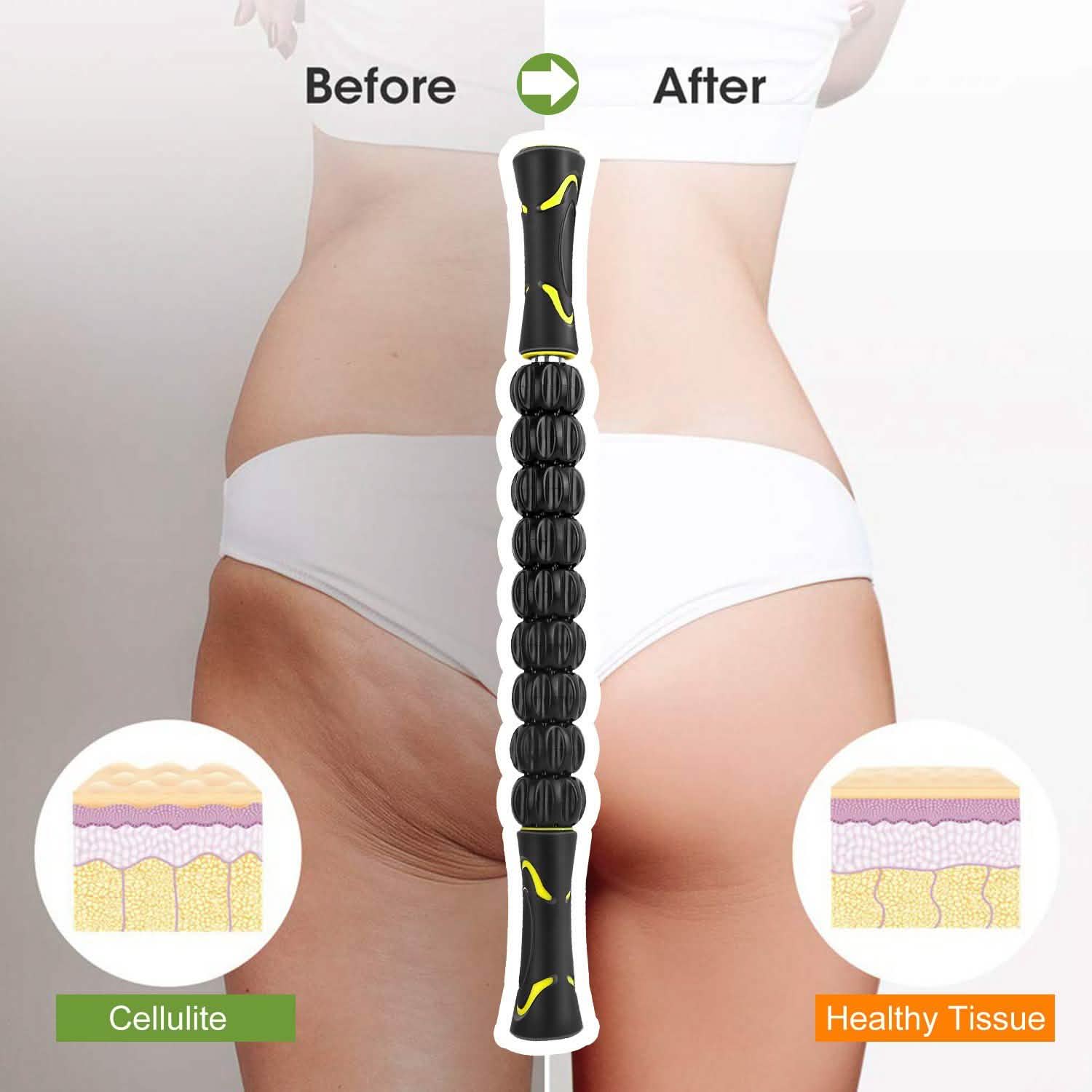Muscle Roller Massage Stick Body Physical Therapy Health & Wellness - Tophatter Daily Deals