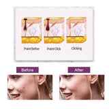 Portable Multi Level Beauty Equipment Beauty & Personal Care - Tophatter Daily Deals