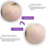 Portable Multi Level Beauty Equipment Beauty & Personal Care - Tophatter Daily Deals