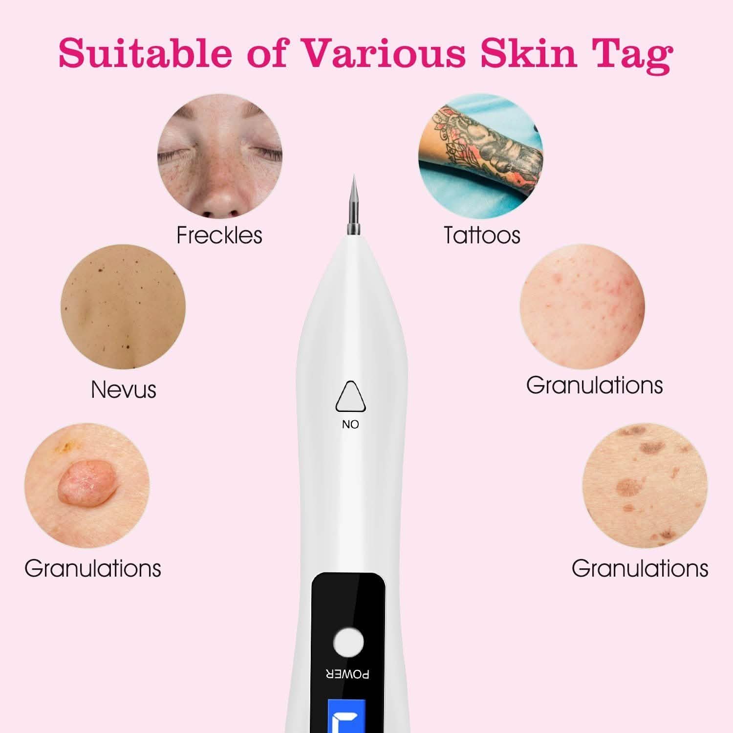 Portable Skin Tag Repair Kit with 6 Replaceable Needles Beauty & Personal Care - Tophatter Daily Deals