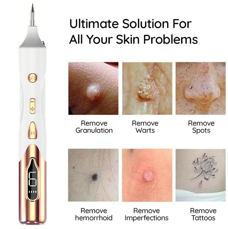 Mole Remover Pen Home Skin Tag Removal Painless Safe - Tophatter Daily Deals