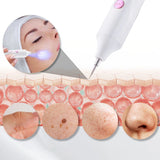 Mole Remover Pen Home Skin Tag Removal Painless Safe - Tophatter Daily Deals