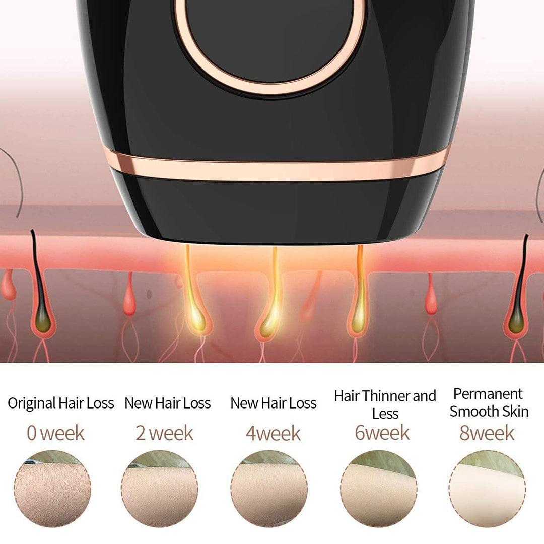Home Hair Removal Laser - Laser Hair Removal Machine Permanent Painless Epilator Body Facial Personal Care - Tophatter Daily Deals