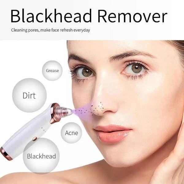 Best Blackhead Remover Vacuum - Professional Pore Cleaner Vacuum Blackhead Remover Rechargeable 5 Suction Levels Health & Beauty - Tophatter Daily Deals