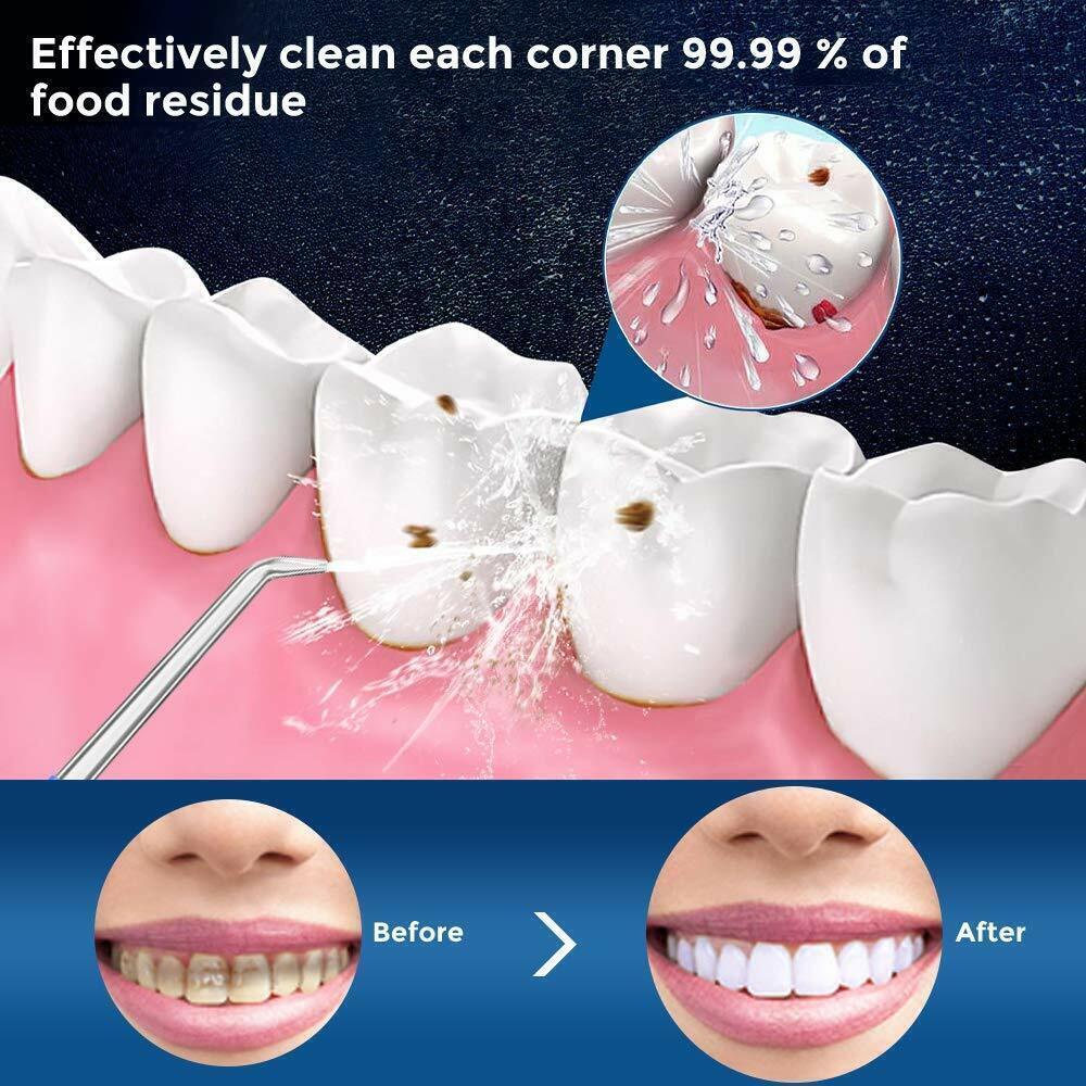 Waterpik Cordless Water Flosser - Cordless Water Flosser Dental Oral Irrigator for Teeth Cleaner 8 Jet Tips Dental Tools - Tophatter Daily Deals