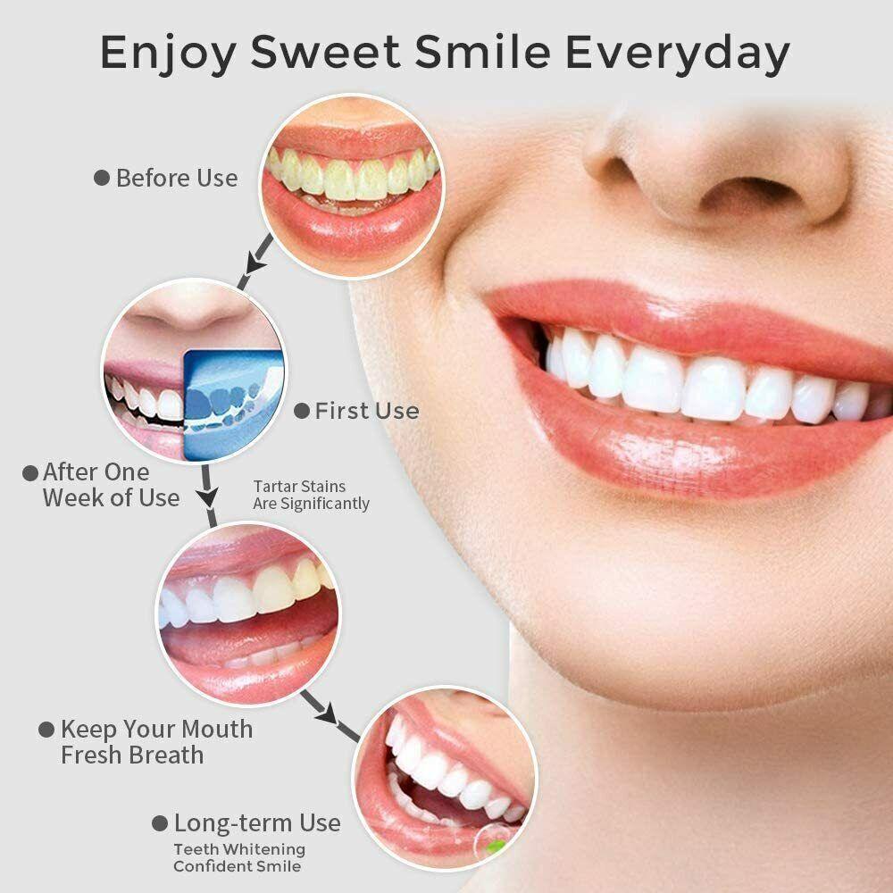Waterpik Cordless Water Flosser - Cordless Water Flosser Dental Oral Irrigator for Teeth Cleaner 8 Jet Tips Dental Tools - Tophatter Daily Deals