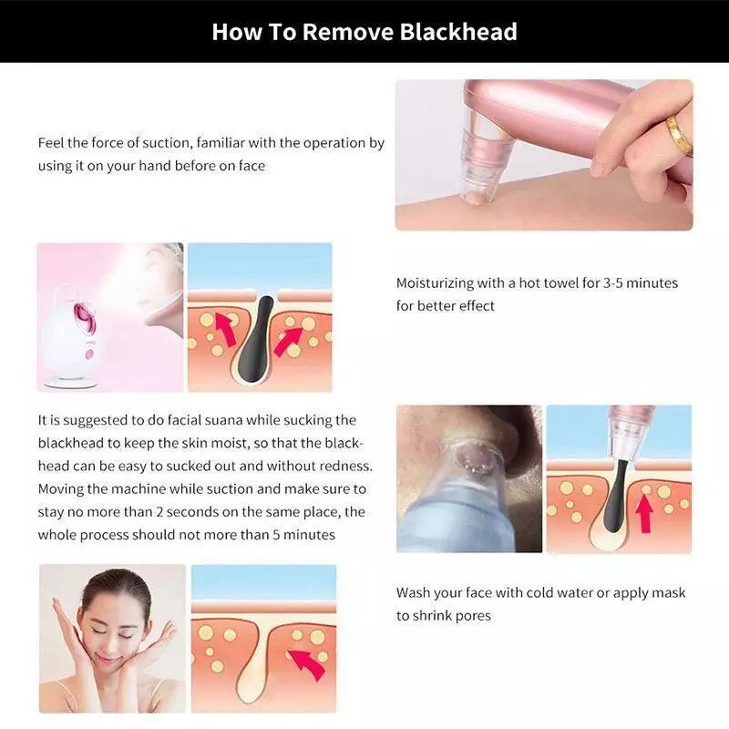 Best Blackhead Remover Vacuum - Professional Pore Cleaner Vacuum Blackhead Remover Rechargeable 5 Suction Levels Health & Beauty - Tophatter Daily Deals