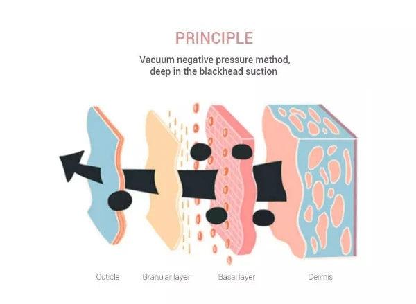 Best Blackhead Remover Vacuum - Professional Pore Cleaner Vacuum Blackhead Remover Rechargeable 5 Suction Levels Health & Beauty - Tophatter Daily Deals