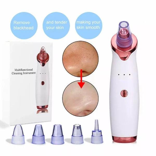 Best Blackhead Remover Vacuum - Professional Pore Cleaner Vacuum Blackhead Remover Rechargeable 5 Suction Levels Health & Beauty - Tophatter Daily Deals