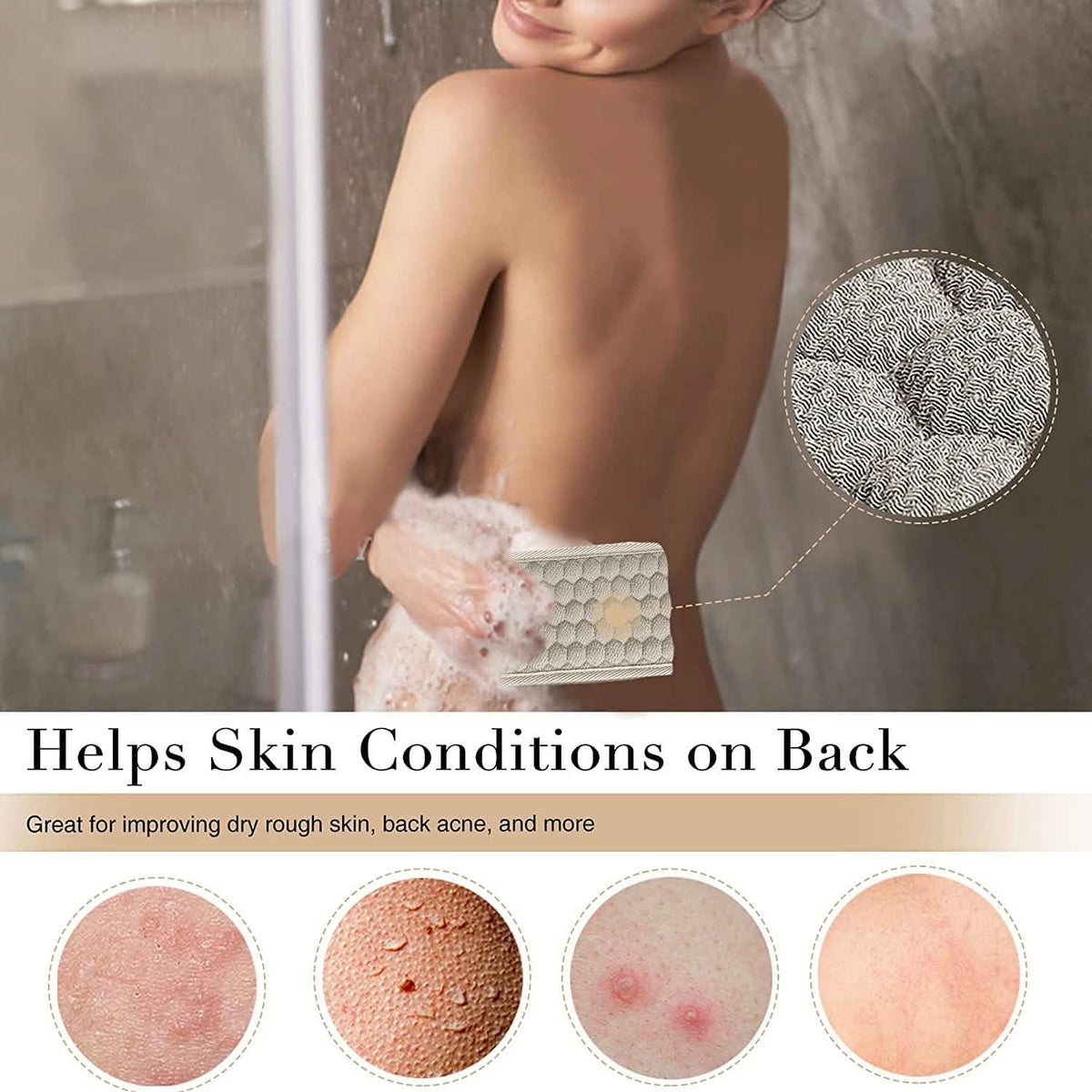Suntee Exfoliating Back Scrubber and Exfoliating Sponge Pad Bath - Tophatter Daily Deals