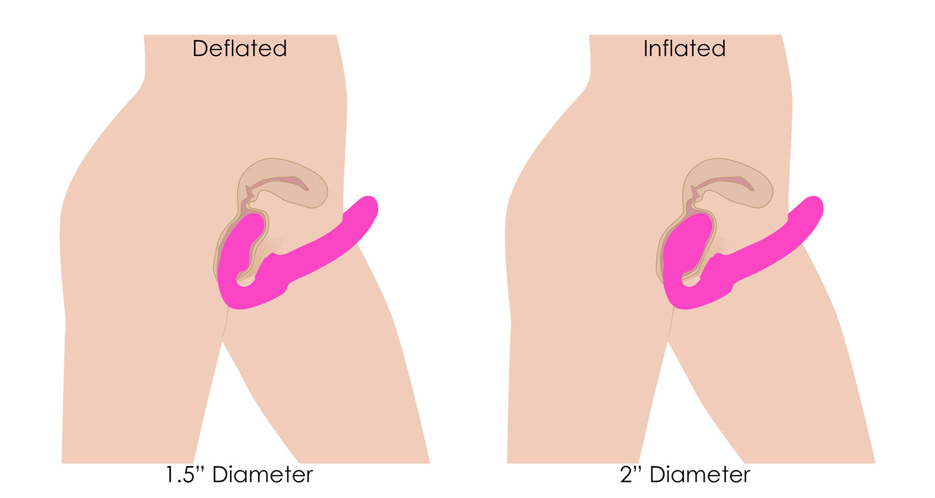 Worlds First Remote Control Inflatable Ergo-Fit Strapless Strap-On – Remote-Controlled Strapless Strap-On > Dildos > Strapless Strap Ons - Tophatter Daily Deals